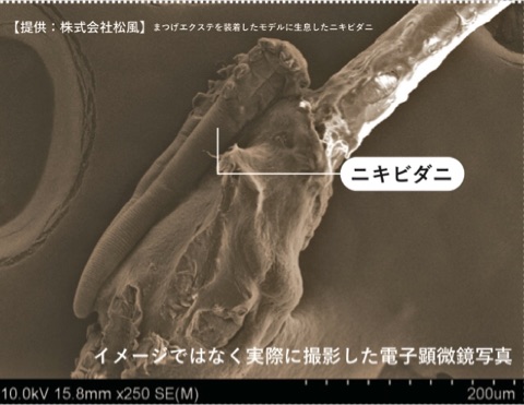 ニキビダニ セール まつ毛